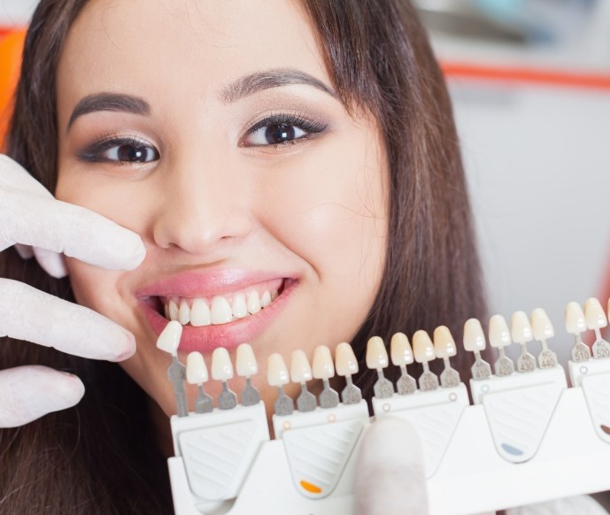 Shade matching a womans smile for veneers