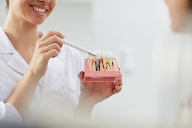 a dentist showing a model of a dental implant